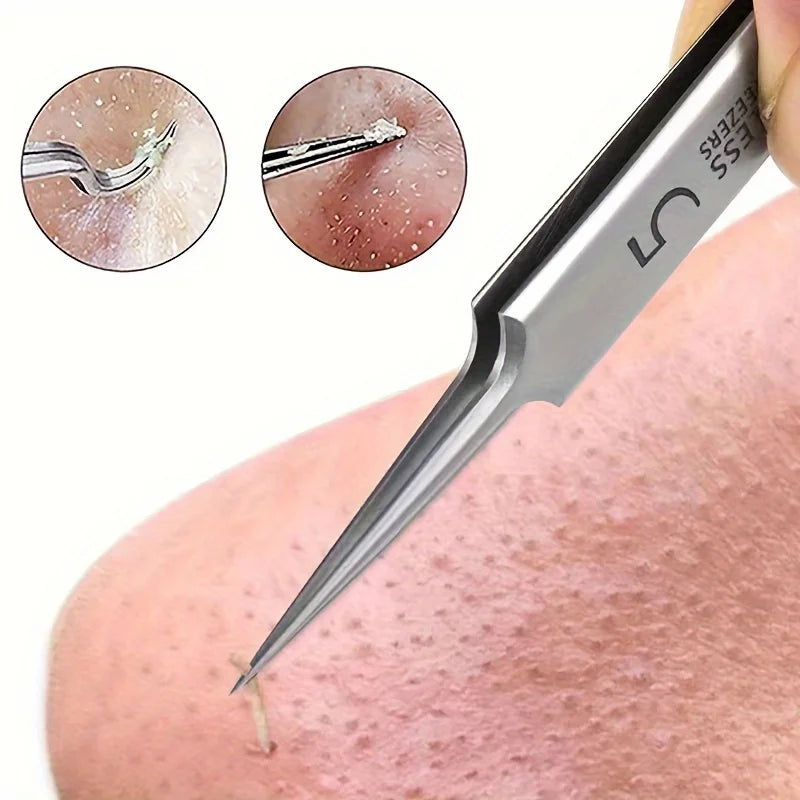 1 Pack Cellular Acne Blackhead Tweezers
